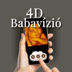 4D Babavízió - Ultrahangos szakember