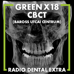 GREEN X18 CBCT felvétel - Fogászati és fül-orr-gégészeti röntgen, cbct készítése